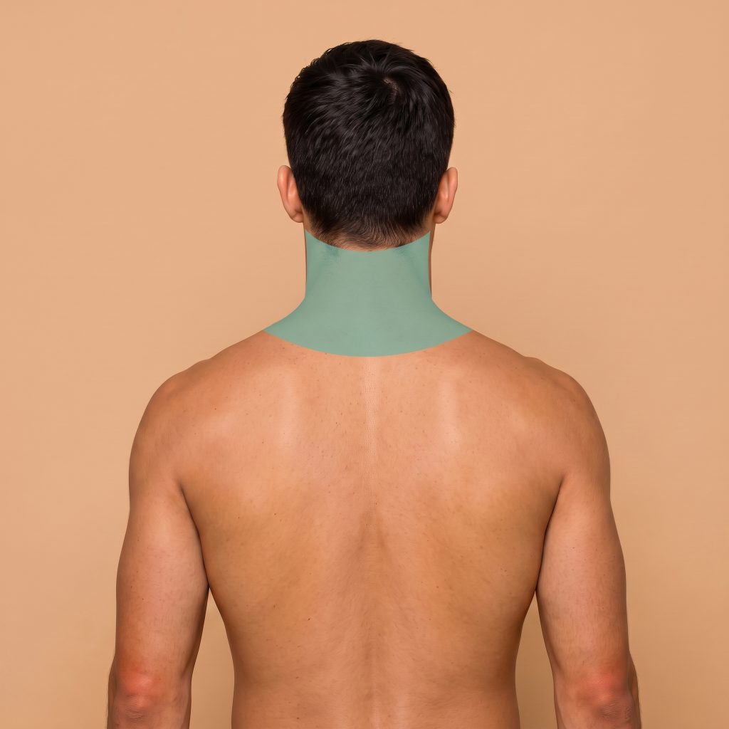 Cuello Posterior