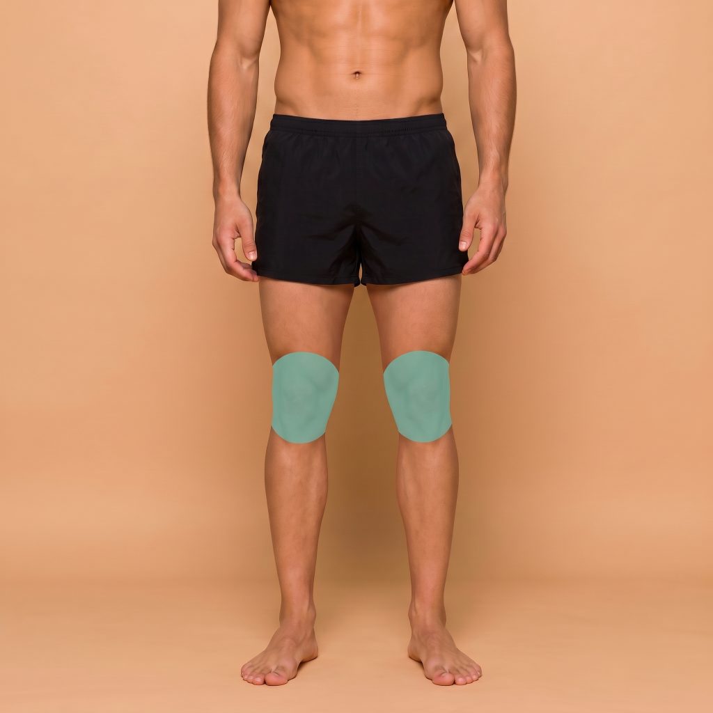 Rodilla